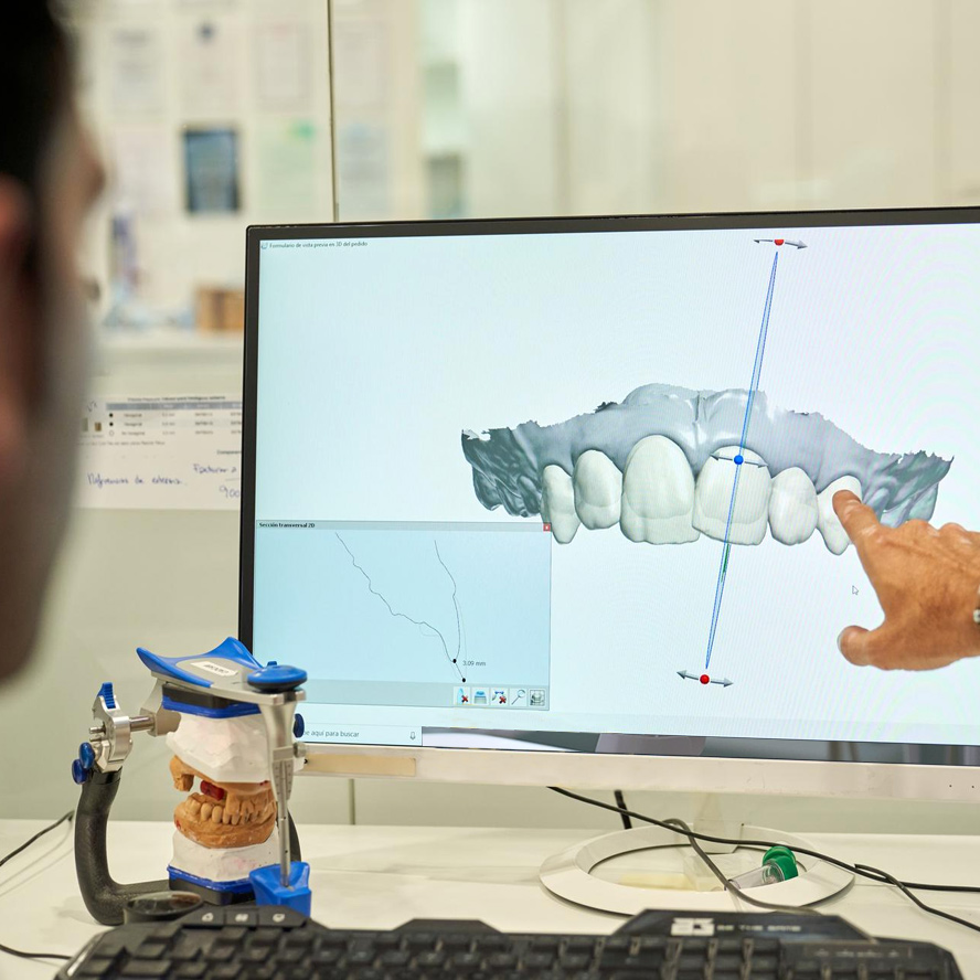 capsule ceramica 3d