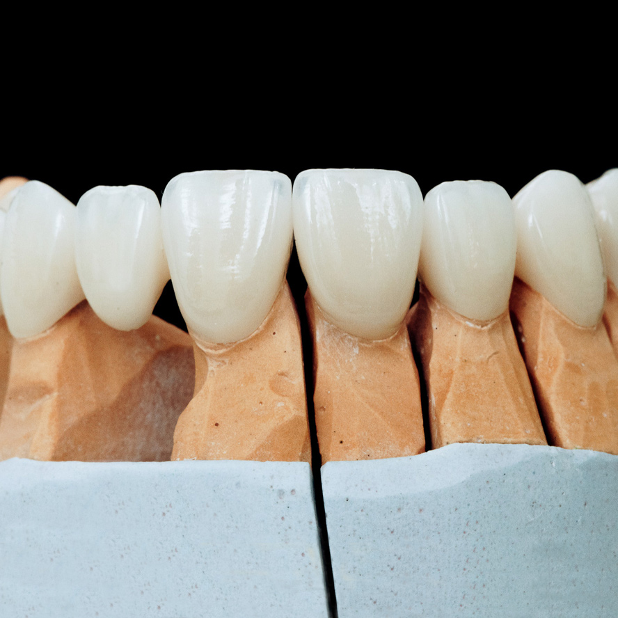 capsule ceramica 3d